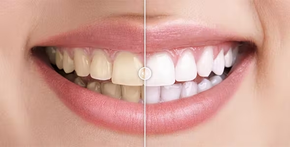 Before and After Images Comparison Plugin